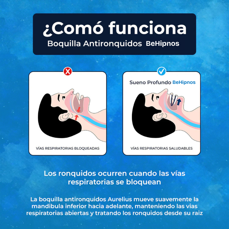 Boquilla Antirronquidos - ¡Deje de roncar ya! 🇵🇾