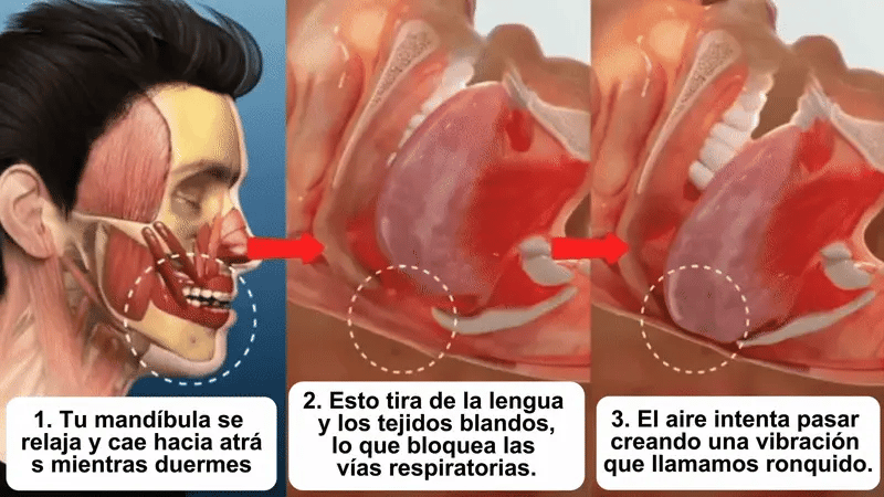 ¡Estás A Un Paso De Dormir Sin Ronquidos Y Despertar Con Energía Todo El Día!